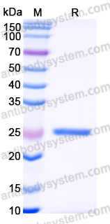 Recombinant Human ASF1A Protein, N-T7 & C-His