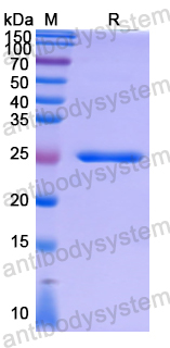 Recombinant Human ASZ1 Protein, N-His