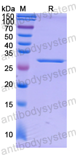 Recombinant Human ATP6V1D Protein, N-His