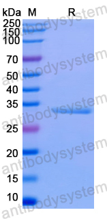 Recombinant Human BBS2 Protein, N-His