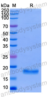 Recombinant Human EIF5A2 Protein, N-His