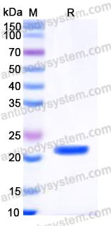 Recombinant Human EIF5A2 Protein, N-His