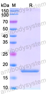 Recombinant Human AIDA Protein, N-His