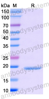 Recombinant Human RGS17 Protein, N-His