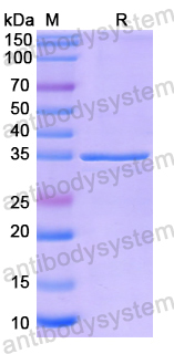 Recombinant Human ALKBH4 Protein, N-His