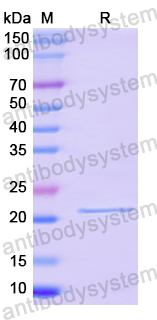 Recombinant Human STEAP3 Protein, N-His