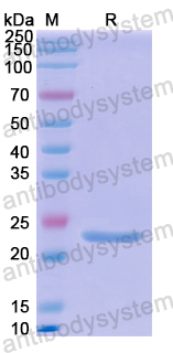Recombinant Human ATP6V0A1 Protein, N-His-SUMO & C-Strep