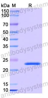 Recombinant Human COMMD5 Protein, N-His