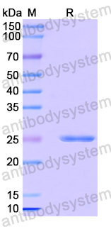 Recombinant Human DDA1 Protein, N-His-SUMO & C-Strep