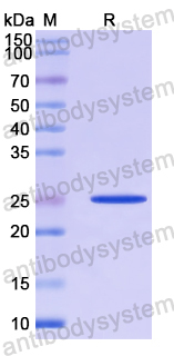 Recombinant Human FAF1 Protein, N-His