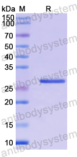 Recombinant Human FLCN Protein, N-His