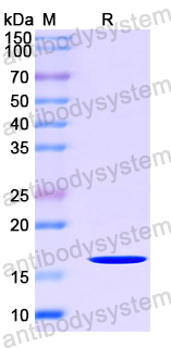 Recombinant Human GLRX2 Protein, N-His
