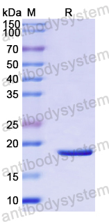 Recombinant Human HECTD1 Protein, N-His