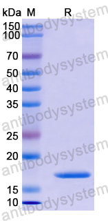 Recombinant Human MSRB2 Protein, N-His