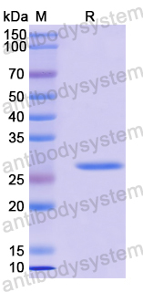 Recombinant Human TESC Protein, N-His