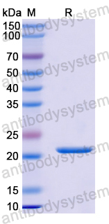 Recombinant Human TIMM13 Protein, N-His-SUMO