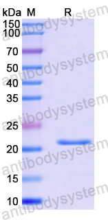 Recombinant Human TRIM69 Protein, N-His