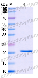 Recombinant Human TRIM9 Protein, N-His