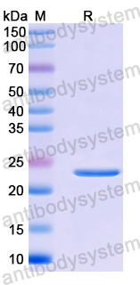 Recombinant Human ULBP1 Protein, N-His