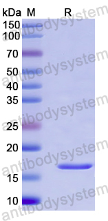 Recombinant Human USP20 Protein, N-His