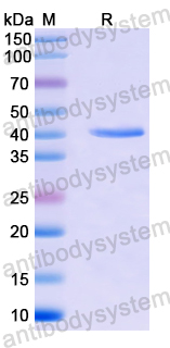 Recombinant Human USP22 Protein, N-His
