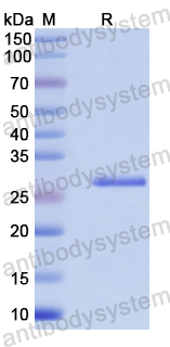Recombinant Human XRN2 Protein, N-His