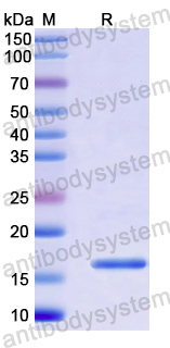 Recombinant Human ZBTB18 Protein, N-His