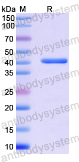 Recombinant Human ACSS2 Protein, N-His