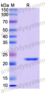 Recombinant Human GADD45GIP1 Protein, N-His
