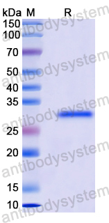 Recombinant Human APBB1IP Protein, N-His
