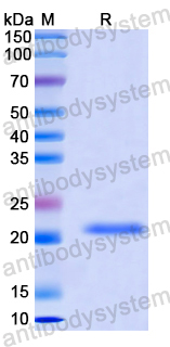 Recombinant Human RAB3IP Protein, N-His