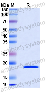 Recombinant Human NXF1 Protein, N-His