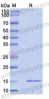 Recombinant Human STAC3 Protein, N-His