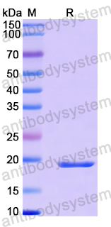 Recombinant Human STMN3 Protein, N-His-SUMO