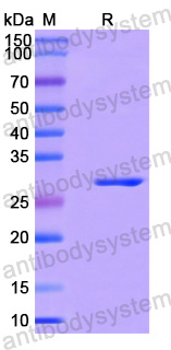 Recombinant Human UCK2 Protein, N-His
