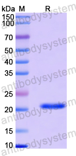 Recombinant Human AEBP2 Protein, N-His-SUMO