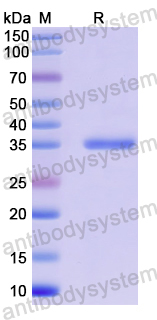 Recombinant Human TBC1D23 Protein, N-His