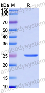 Recombinant Human TRIM46 Protein, N-His