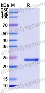 Recombinant Human WDR24 Protein, N-His-SUMO