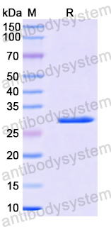 Recombinant Human USP24 Protein, N-His