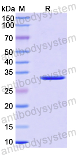 Recombinant Human CNOT9 Protein, N-His