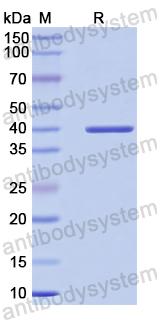 Recombinant Human EXOSC3 Protein, N-His