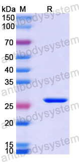 Recombinant Human HORMAD1 Protein, N-His