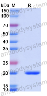 Recombinant Human TRIM11 Protein, N-His