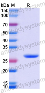Recombinant Human BBS7 Protein, N-His