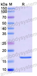 Recombinant Human CMIP Protein, N-His