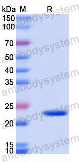 Recombinant Human ARHGAP10 Protein, N-His