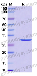 Recombinant Human LHPP Protein, N-His