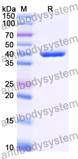 Recombinant Human LHPP Protein, N-His-SUMO