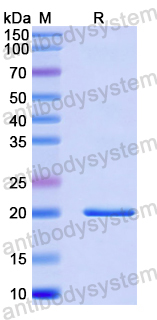 Recombinant Human RILP Protein, N-His